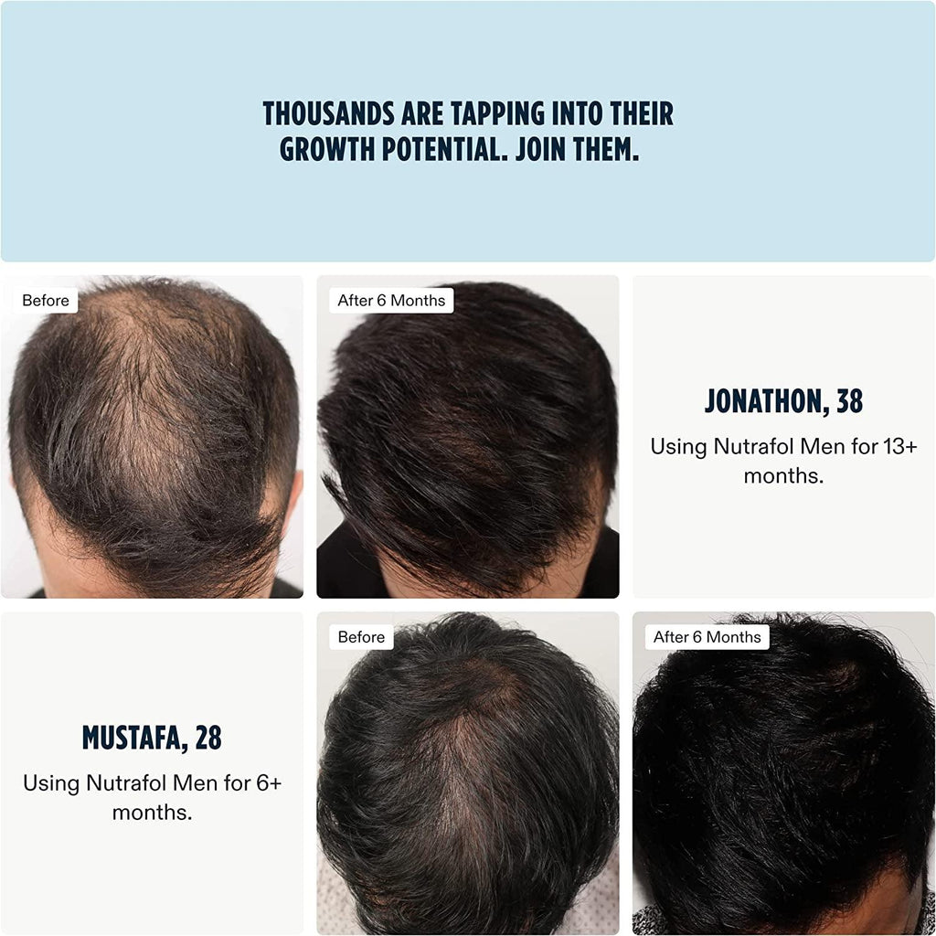 Men'S Hair Growth Supplement | Clinically Tested for Visibly Thicker & Stronger Hair with More Scalp Coverage | Dermatologist Recommended | 1 Bottle | 1 Month Supply